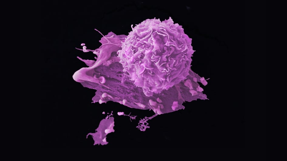 黑色背景上的乳腺癌细胞