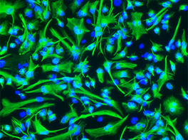 从培养的脑癌干细胞中提取星形胶质细胞