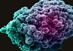 乳腺癌细胞547 x 383