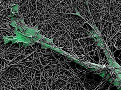 绿色黑色素瘤细胞通过网状水凝胶基质生长的显微镜图像.