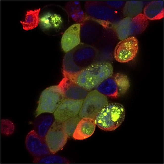Head and neck cancer cells infected with Vaccinia virus and labelled with fluorescent dye