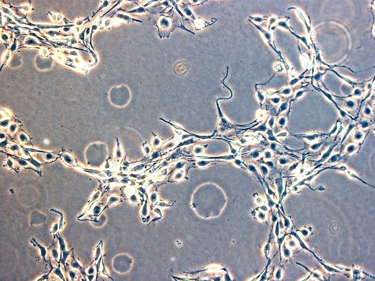 Cancer cells in a dish