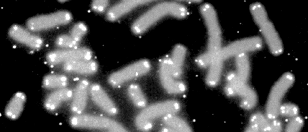 Black and white image of telomeres.