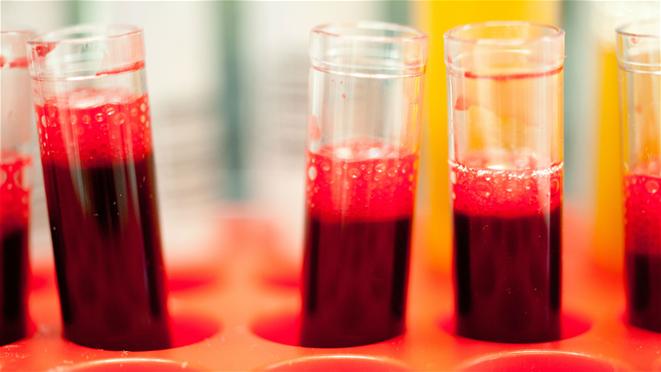 Blood Sample Test Tubes
