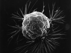 Five ways the ICR is defeating breast cancer