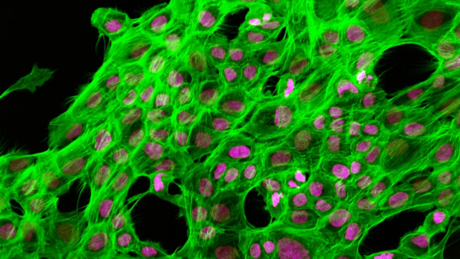 Breast epithelial cells stained for DNA (magenta) and actin (green). Julia Sero / the ICR, 2011