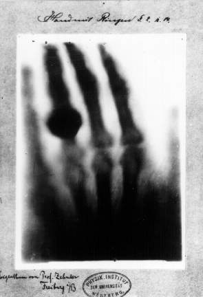 Hand mit Ringen (Hand with Rings) 1896: a print of one of the first X-rays by Wilhelm R&#246;ntgen (1845–1923) of the left hand of his wife Anna Bertha Ludwig.