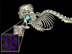 Using molecular imaging to take a snapshot of cancer and its treatment