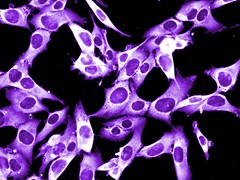 Melanoma cancer cells (photo: istockphoto.com/Plinio R Hurtado/Dlumen)
