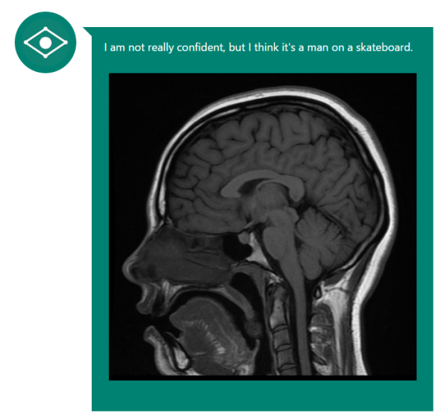 Microsoft's CaptionBot incorrectly identifies a brain MRI scan