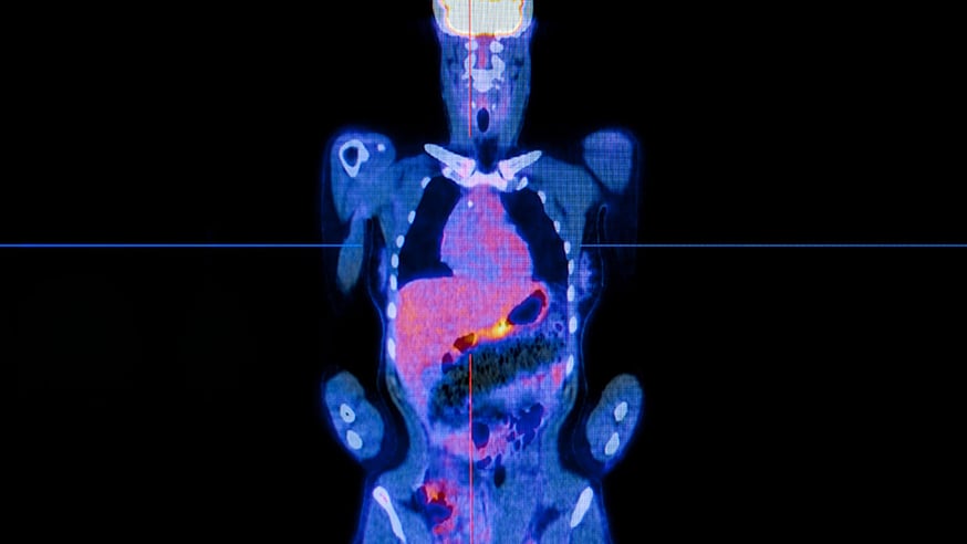 pet-scan embed
