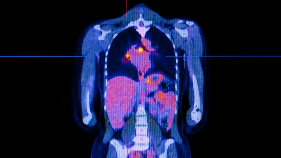 Radiology scan of a torso