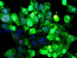 Cancer-killing virus boosts immunotherapy in hard-to-treat cancer