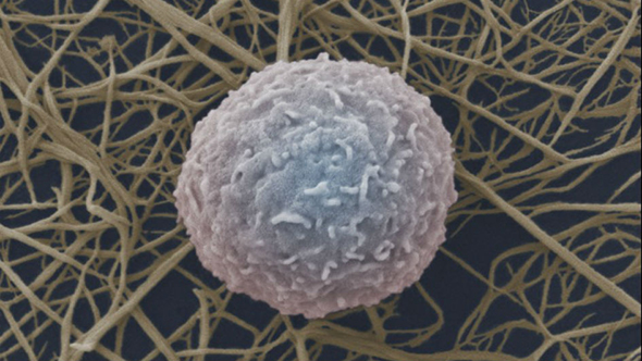 A white blood cell of the immune system (photo: Wellcome Images)
