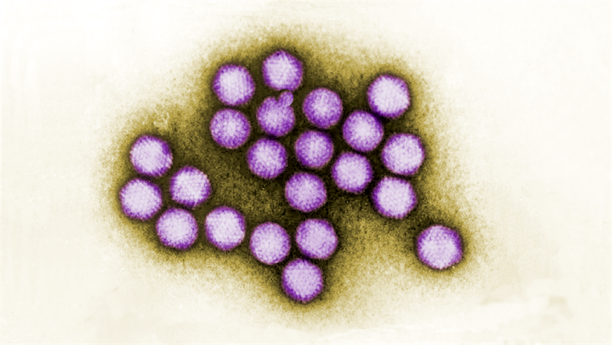 Digitally-colourised transmission electron microscopic image of adenovirus