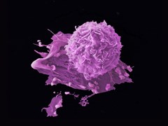 Breast cancer cells on a black background