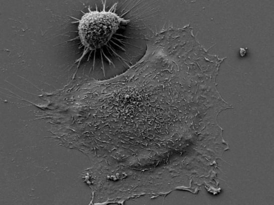 Caption for: Cancer cells shrink or super-size to survive