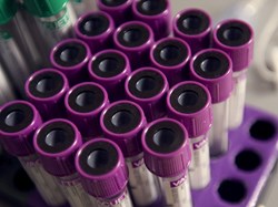 New three-in-one blood test opens door to precision medicine for prostate cancer