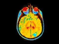 A single image of a human brain using a magnetic resonance imaging (MRI) machine