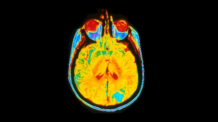 A single image of a human brain using a magnetic resonance imaging (MRI) machine