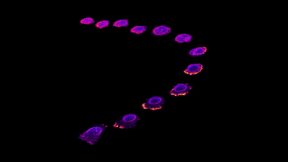 Breast cancer cell timelapse