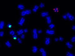 Microscope image of chromosomes
