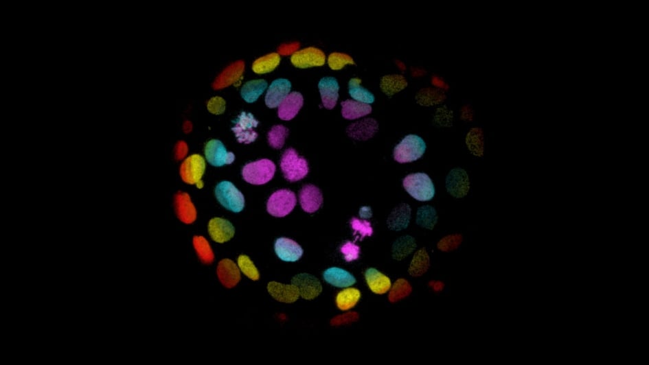 Colorectal cells grown into organoids, coloured red, yellow, blue and purple
