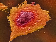 colour-enhanced-image-of-human-colon-cancer-cells-in-culture-945x532px