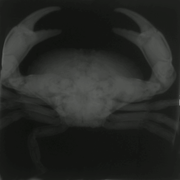 2D and 3D images of a crab acquired using CT scans and MRI to guide radiotherapy treatment. 