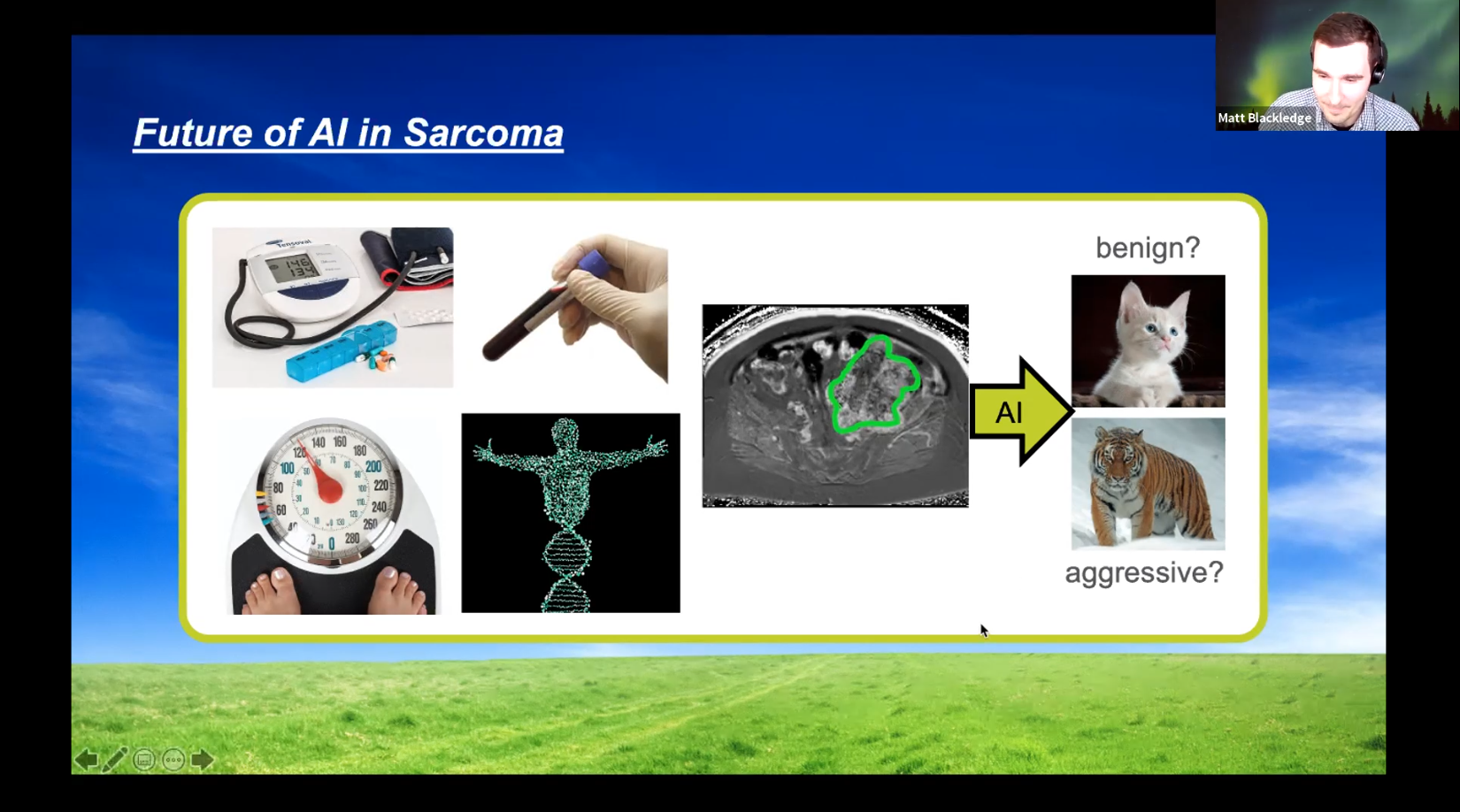 Zoom presentation screenshot of Dr Matthew Blackledge talking about the future of AI in sarcoma 