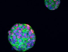 Proliferating cells in a tumour organoid of triple-negative breast cancer. Image credit: Dr Rebecca Marlow / ICR