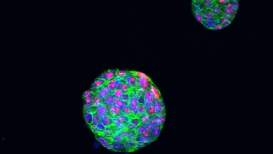 Proliferating cells in a tumour organoid of triple-negative breast cancer. Image credit: Dr Rebecca Marlow / ICR