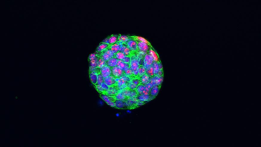 Dr Rebecca Marlow - Proliferating cells in a tumour organoid of triple-negative breast cancer