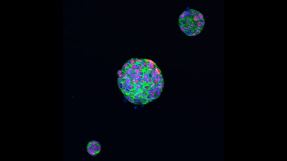 Proliferating cells in a tumour organoid of triple-negative breast cancer 945x532px