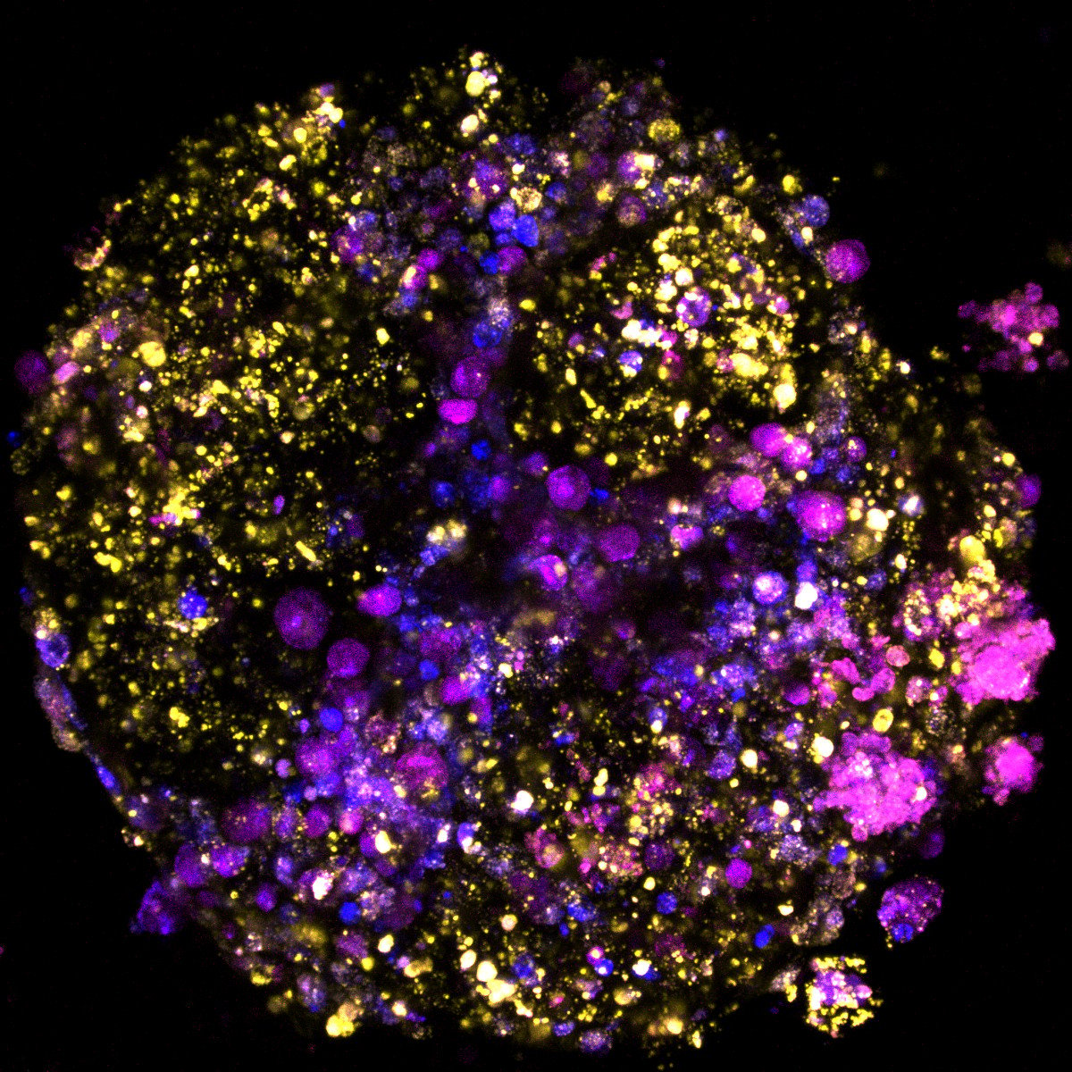 Forward and reverse translation in tumour organoids by PhD Student Somaieh Hedayat and Louise Howell