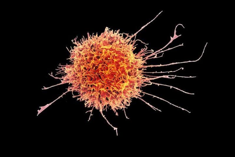 Colourised scanning electron micrograph of a natural killer cell from a human donor