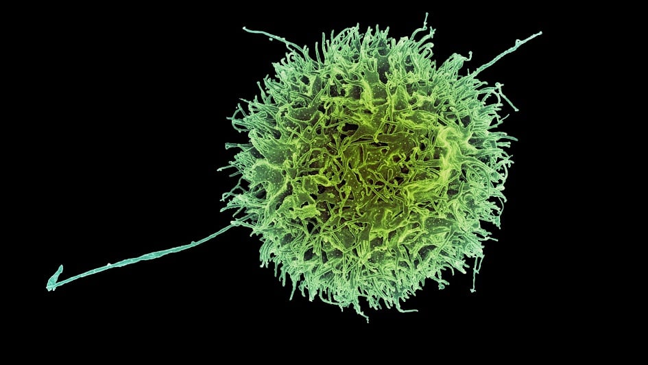 Colorized scanning electron micrograph of a natural killer cell from a human donor. Credit: NIAID