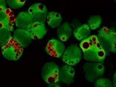 Immunofluorescent image of autophagosomes in multiple myeloma cells 547x410px