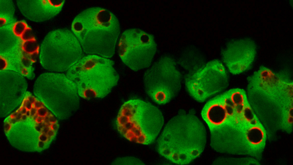 Immunofluorescent image of autophagosomes in multiple myeloma cells