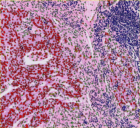 Image of cells with data points over them from the joint integrated pathology unit