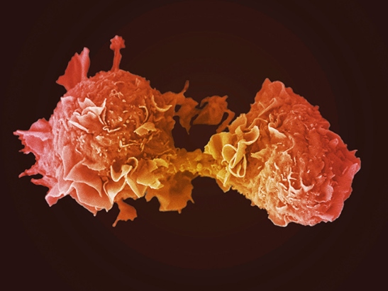 Caption for: Immunotherapy drug combination stimulates immune system against resistant cancers