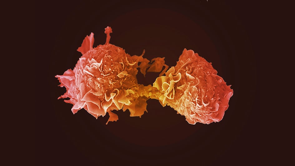 Lung cancer cells dividing