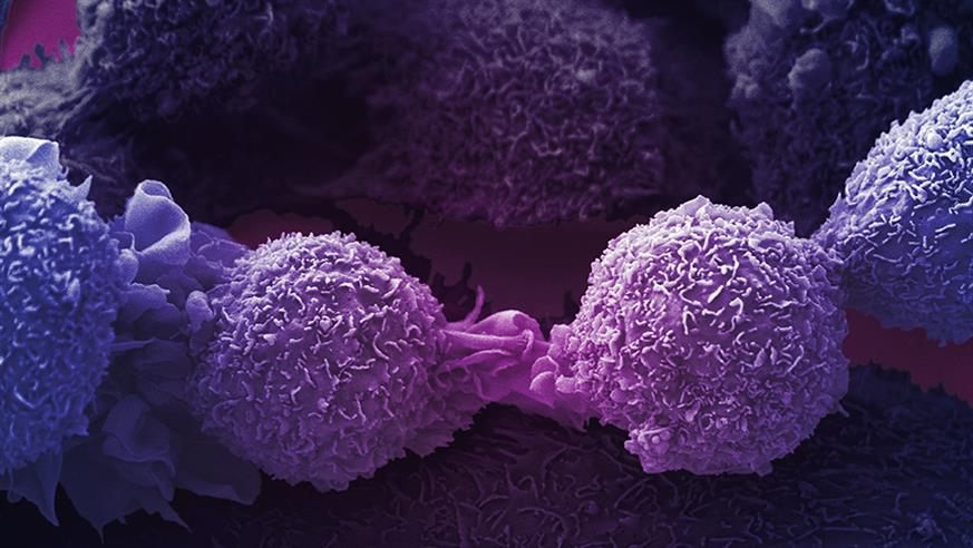 Purple lung cancer cells