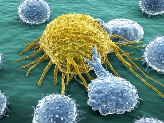 Caption for: Immune cells hunt down cancer around the body – discovery could lead to personalised treatments for advanced breast cancer