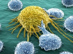 Lymphocytes in blue surround a yellow cancer cell