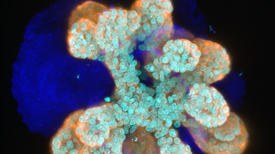 Close up of cells in a mammary organoid as seen through a microscope