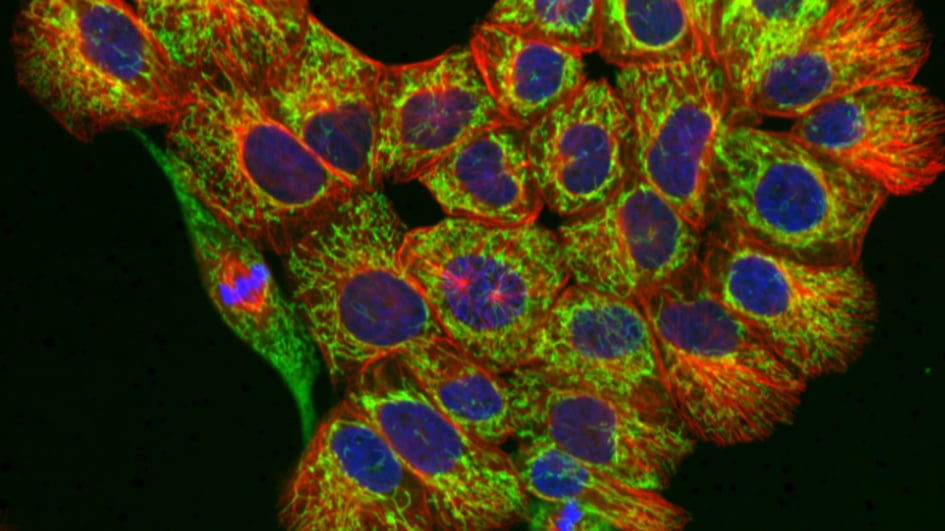 Normal breast epithelial cells with stained mitochondria (green), microtubules (red) and DNA (blue)