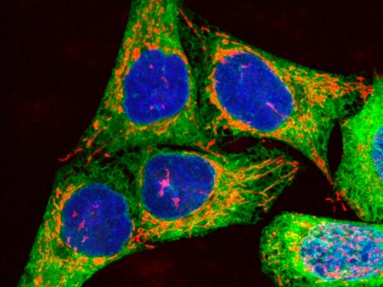 Caption for: Scientists identify potential new drug combination for some skin cancers