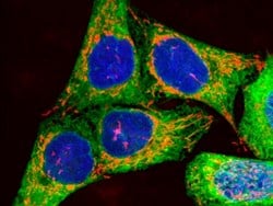 Scientists identify potential new drug combination for some skin cancers