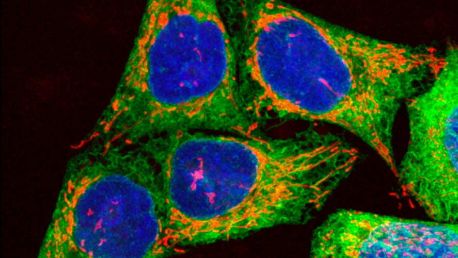 Human melanoma cells growing in culture, showing DNA, mitochondria and endoplasmic reticulum (ER).